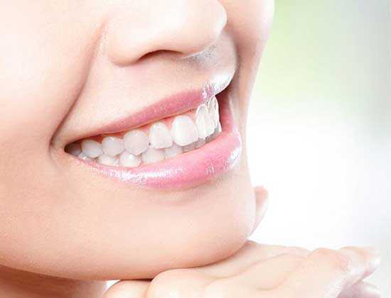 Rezultat tratament dentar la clinica Bident — După