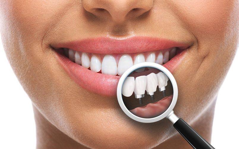Implantologie/ Chirurgie