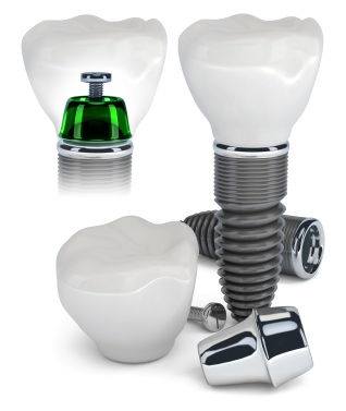 Implantologie/ Chirurgie