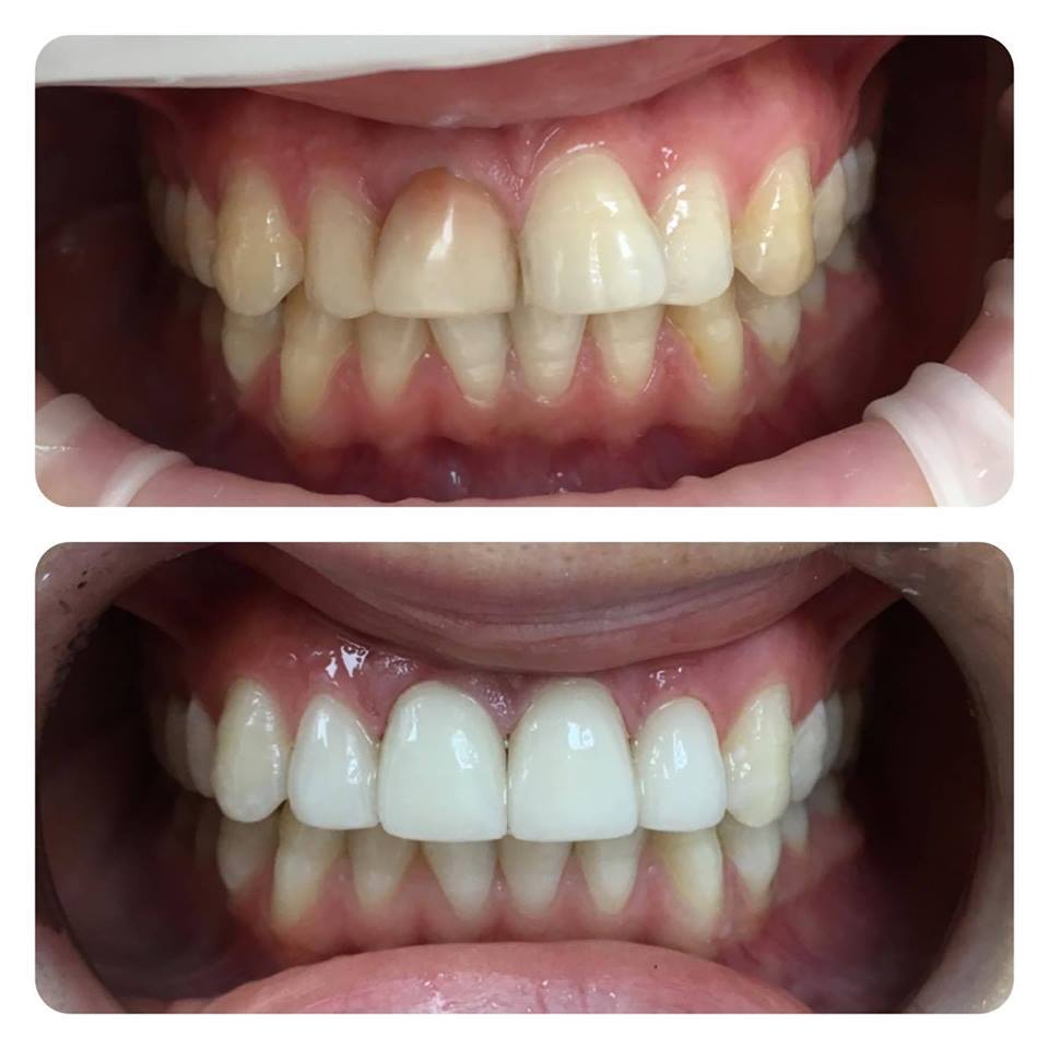 Implantologie/ Chirurgie