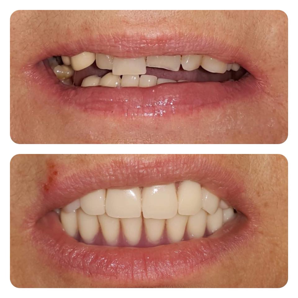 Implantologie/ Chirurgie