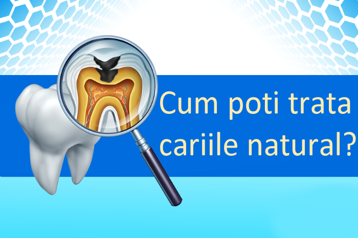 Tratament carii