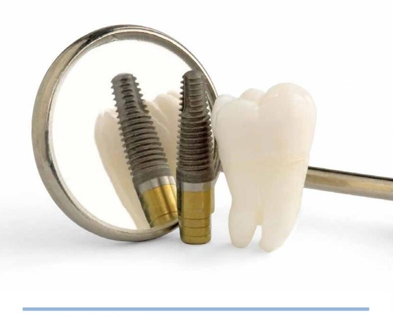Implant dentar & chirurgie orală